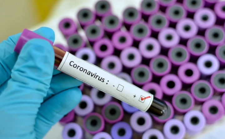 Ermənistanda 189 nəfərdə koronavirus aşkarlanıb, 5 nəfər ölüb