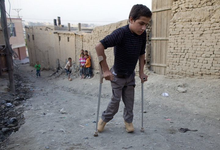 Poliomielitin artması bu ölkənin səhiyyə işçilərini narahat edir