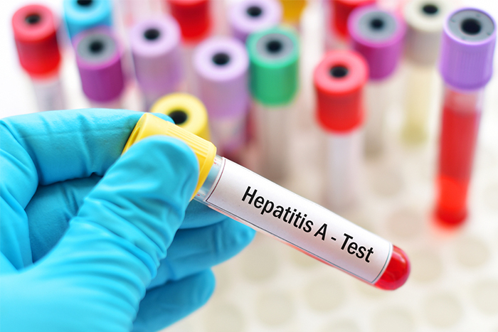 TƏBİB rəsmisi əhalini Hepatit A virusuna qarşı vaksinasiyaya çağırıb