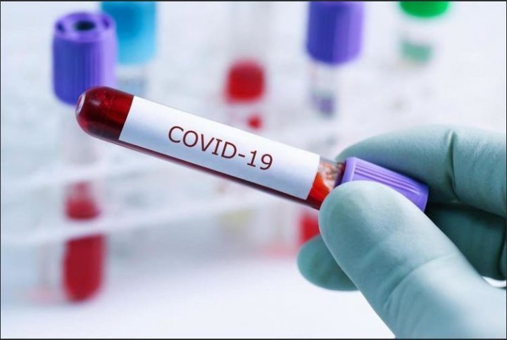 Azərbaycanda daha 49 nəfər koronavirusa yoluxdu, 62 nəfər sağaldı