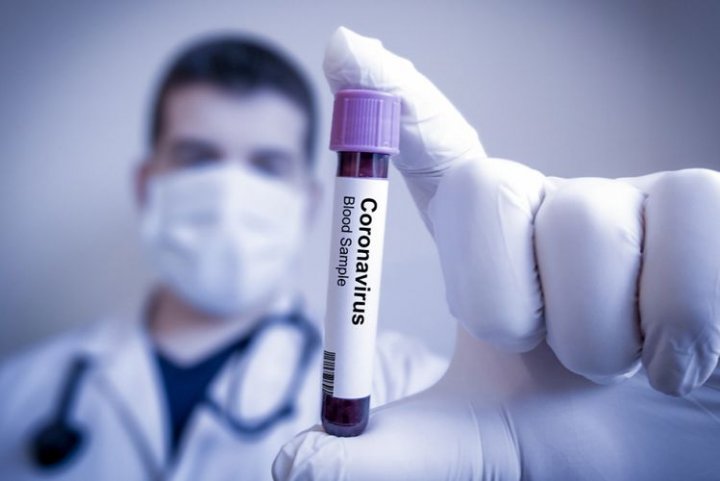 Qazaxıstanda son sutkada koronavirusdan 17 nəfər ölüb