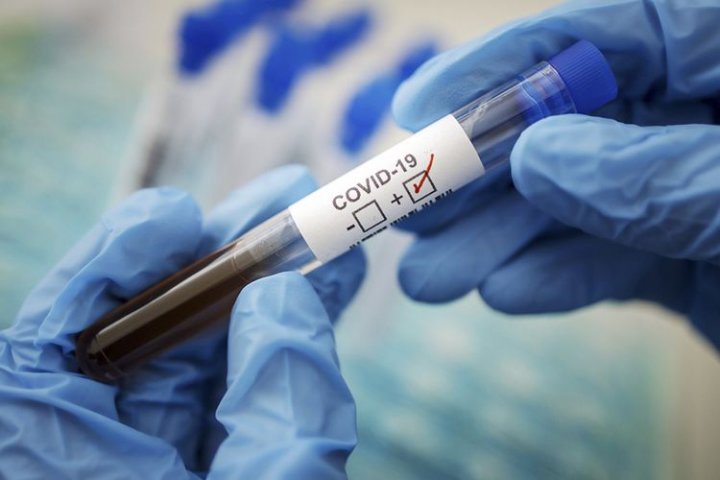Azərbaycanda daha 230 nəfərdə koronavirus aşkarlandı