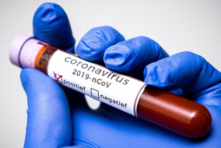 Azərbaycanda daha 556 nəfər koronavirusa yoluxub, 7 nəfər ölüb
