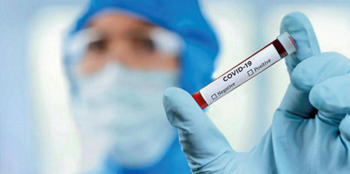 Özəl klinikalarda koronavirus testinin qiyməti necə müəyyən olunur?