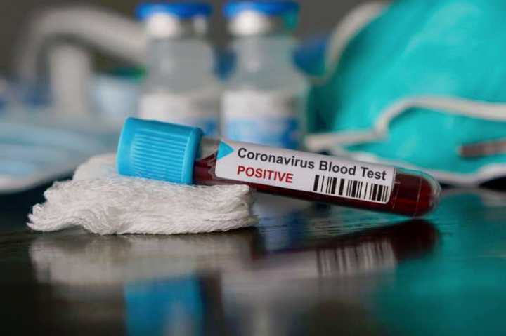 ŞOK AÇIQLAMA: İlk dəfə bu qidada koronavirus aşkarlandı
