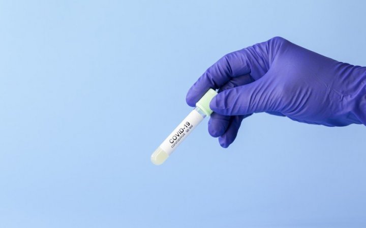 Azərbaycanda son sutkada koronavirusa 474 yeni yoluxma faktı qeydə alınıb