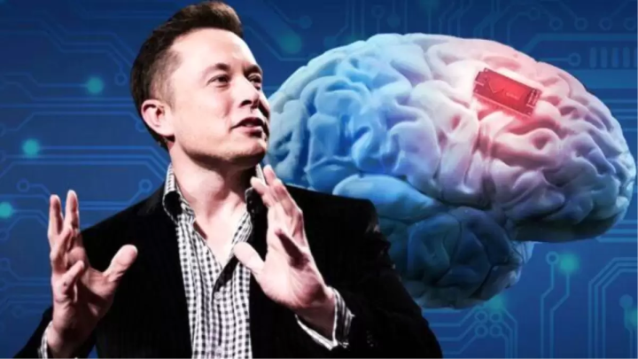 İnsan beyninə xüsusi çip yerləşdiriləcək - Elon Maska icazə verildi