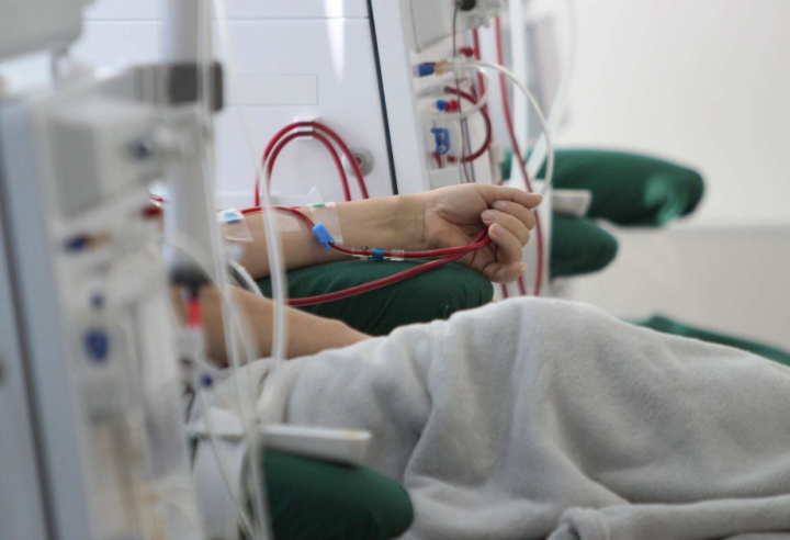 Ölkədə hazırda  9 pasiyent periton dializ müalicəsi alır