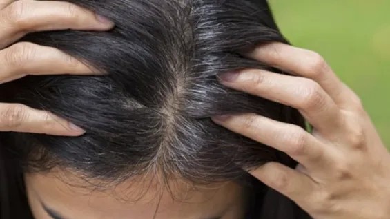 Stress və ağarmış saç arasındakı əlaqə: Elm nə deyir?