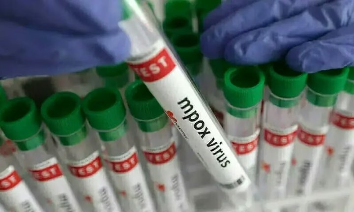 Xayrpurda yeddi uşaqdan dördünün meymun çiçəyi xəstəliyindən öldüyü təsdiqlənib